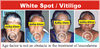 Copyright, Astha Clinic