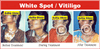 Copyright, Astha Clinic