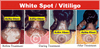 Copyright, Astha Clinic