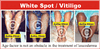 Copyright, Astha Clinic