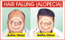Copyright, Astha Clinic