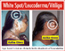 Copyright, Astha Clinic