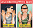 Copyright, Astha Clinic