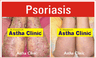Copyright, Astha Clinic