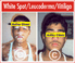 Copyright, Astha Clinic